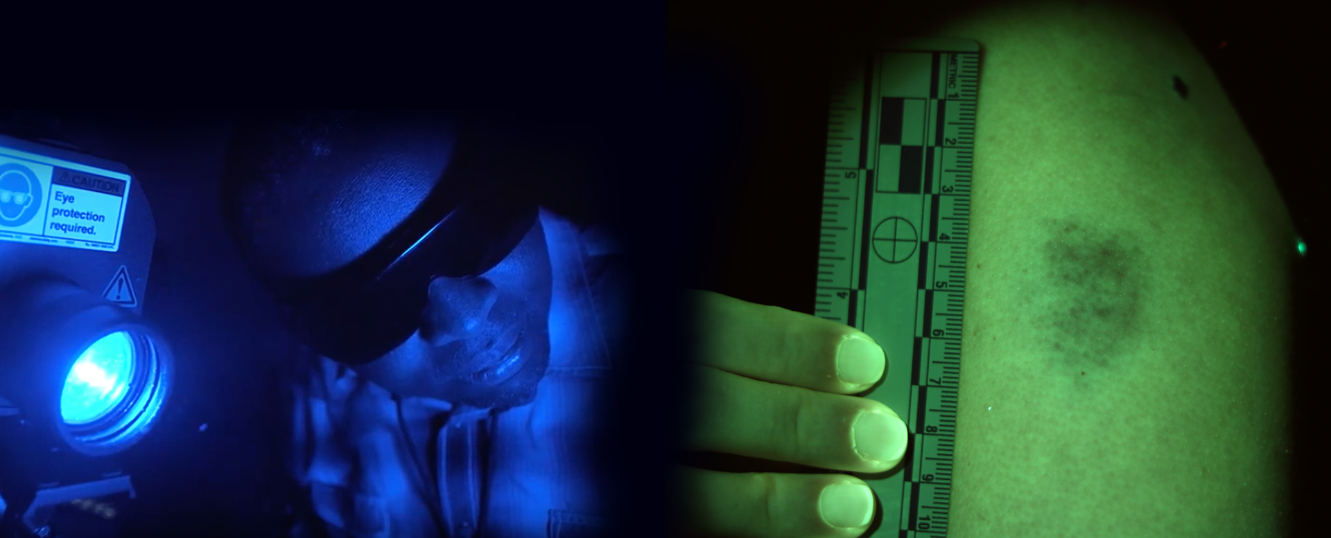 scientist measuring bruises under blue and green lights