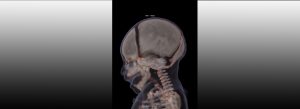 x-ray scans of a deceased person's cranium